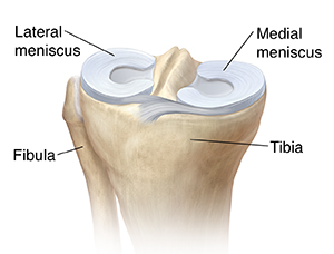 Three-quarter view of top of tibia showing lateral meniscus and medial meniscus.