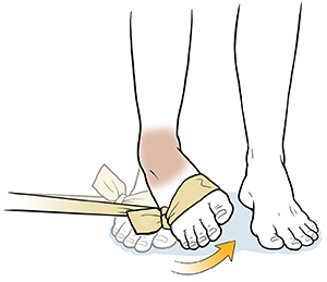 Foot with elastic band around forefoot doing ankle inversion exercise.
