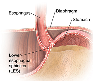 Closeup cross section of lower esophagus.