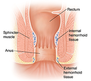 Cross section of normal rectum and anus.