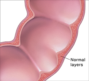 Cross section of colon showing the normal layers of intestine wall.