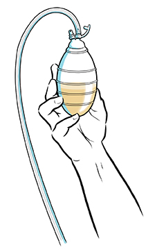 Hand holding drainage bulb with fluid inside.