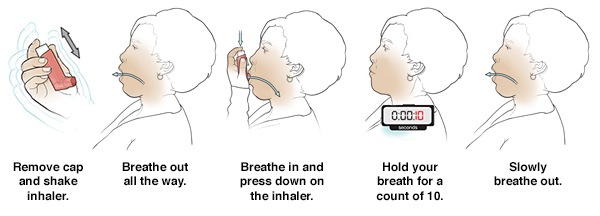 Using an Inhaler