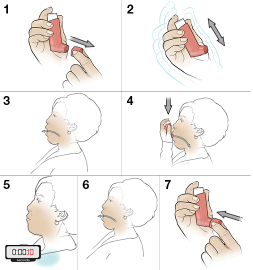 7 steps in using a metered-dose inhaler in mouth without a spacer