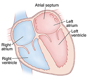 Front view cross section of heart showing atria on top and ventricles on bottom. Atrial septum is between right atrium and left atrium.