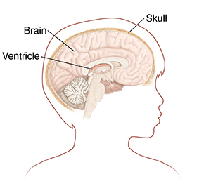 Outline of boy's head in profile showing brain in cross section.