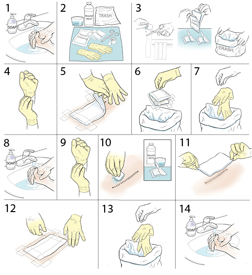 14 steps in changing a surgical wound dressing.