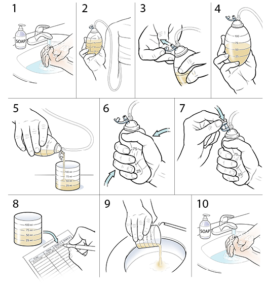 10 steps in how to empty a drain after surgery.