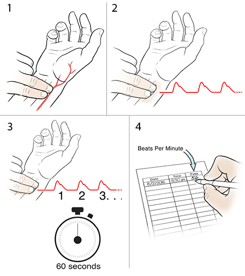 4 steps in taking a radial pulse.