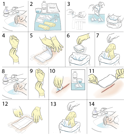 14 steps in changing a wound dressing.