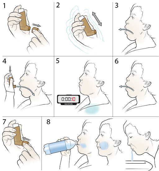 8 steps in using a steroid inhaler.