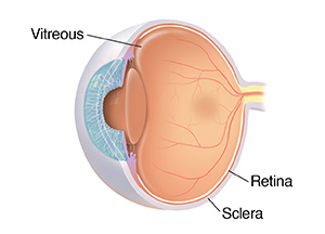 Three-quarter view of cross-sectioned eye showing vitreous.