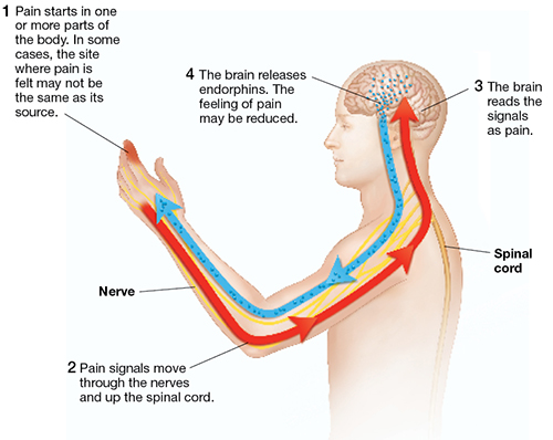 Outline of human figure showing brain and spinal cord. Arrows show pain signals to and from brain.
