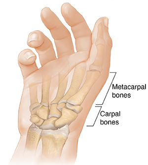 Palm view of hand showing carpals and metacarpals.