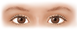 Front view of child’s eyes.