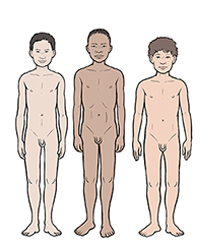 Three boys showing differences in development at age 12.