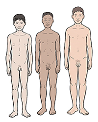 Three boys showing differences in development at age 15.