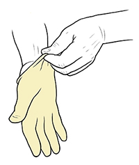 Hand pulling surgical glove on opposite hand.