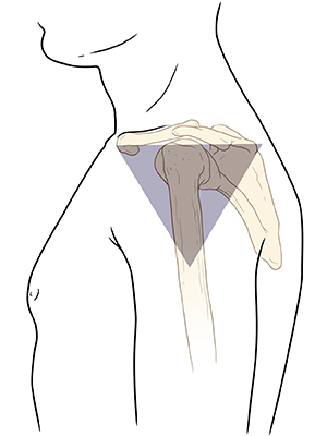 Side view of man's arm showing shaded triangle on skin over shoulder joint.