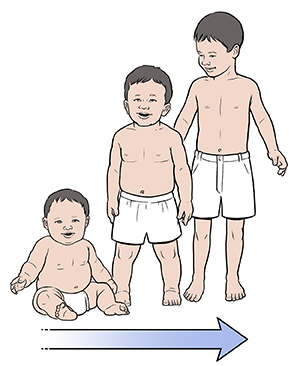 Chubby six-month-old baby. Chubby 12 to 18-month-old baby. Lean 3-year-old toddler. Arrow shows baby developing into lean toddler.