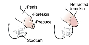 how to retract foreskin