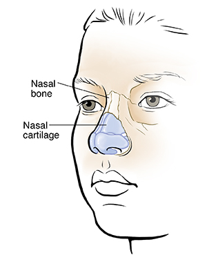 Three-quarter view of child's face showing nasal bones and cartilage.