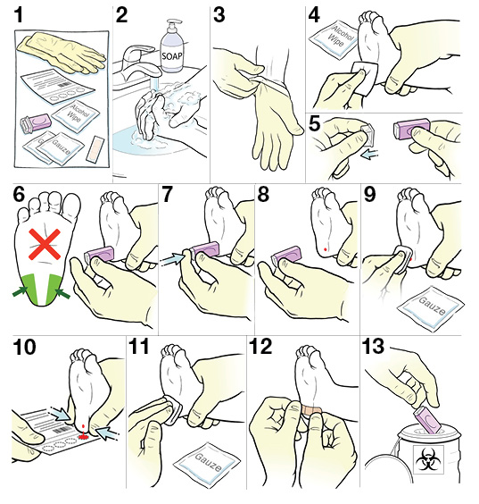 13 steps for doing a heel stick on a baby