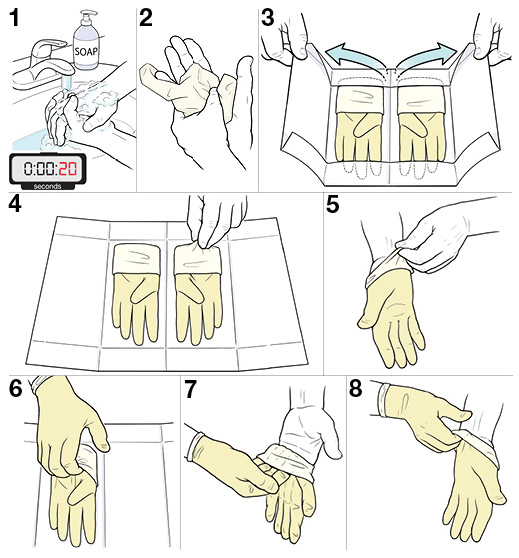 8 steps for putting on sterile gloves