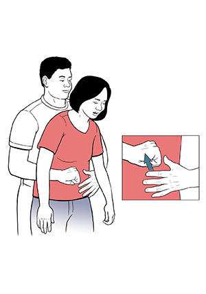 Man standing behind woman with arms around her waist. Inset shows his fist next to her upper abdomen and his other hand flattened and ready to cover his fist.