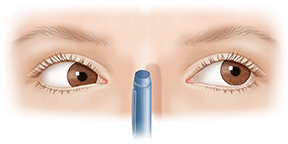 Front view of  adult eyes focusing with convergence insufficiency.