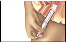 Image of a female injecting a spermicide.
