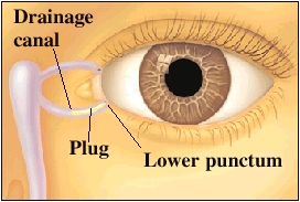 Front view of eye showing plug in drainage system of eye.