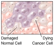 Image showing a damaged normal cell and a dying cancer cell.