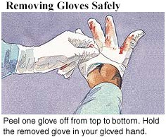 First step in removing gloves safely.
