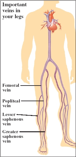 Cutaway view of leg veins