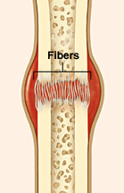 Broken bone showing fibers forming in blood clot at break.