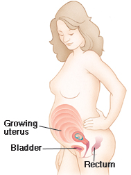 Outline of a pregnant woman showing growing uterus, bladder and rectum