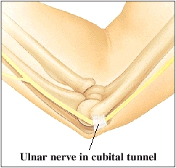 Image of ulnar nerve in cubital tunnel