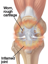 Image of a problem knee