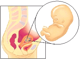 Image of fetus in utero month 2 (weeks 5 - 8). Size of baby is 1"