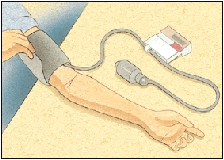 Man wrapping the blood pressure cuff around his arm.