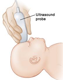Baby's head with hand holding ultrasound probe over forehead.