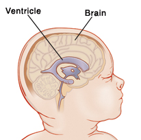 image of normal ventricle inside of brain.