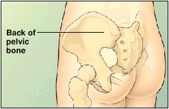 Image of the pelvis showing back of the pelvic bone