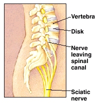 Image showing the sciatic nerve.