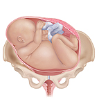 Transverse position showing the baby positioned horizontally across the pelvis