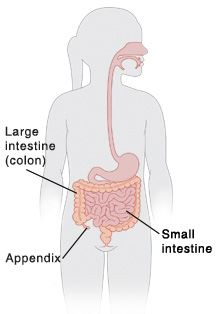 Outline of a child showing the small and large intestines and the appendix.