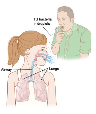 Man coughing, girl breathing bacteria in droplets into lungs.