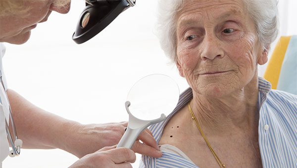 A woman doctor examines moles on the shoulder of a senior woman.
