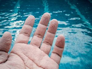 a hand with pruned fingers